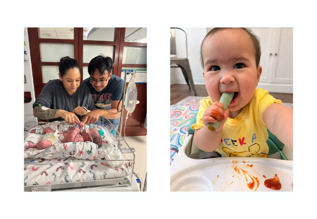 Innovative Pediatric Surgery Helps North Texas Infant Go Home Months Earlier Than Expected Featured Image