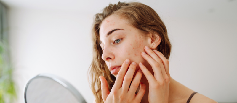 Postpartum Skin Changes Featured Image