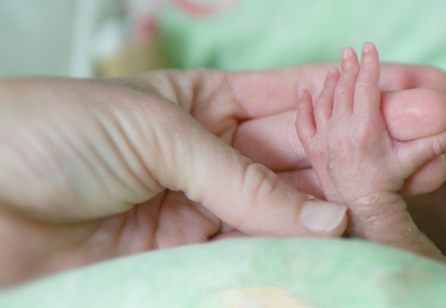 NICU birthday party celebrates micro-preemies born at 22 weeks ...